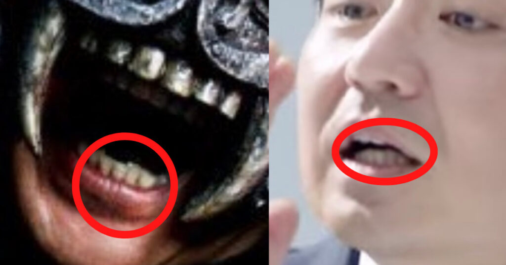 灰鬼と水橋研二の歯並びを比較した画像