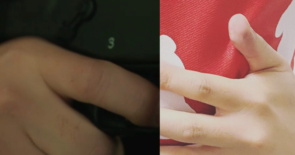 橙鬼と森田甘路の指の比較画像